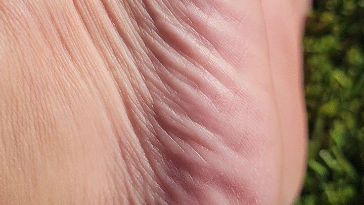 Happily Barefoot - Side foot wrinkles