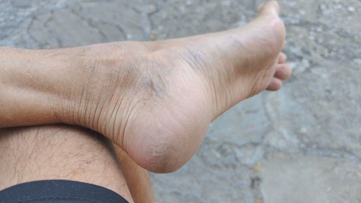 Salvatrix Crucifix - Scratching my ruined long feet and heels on a public bench