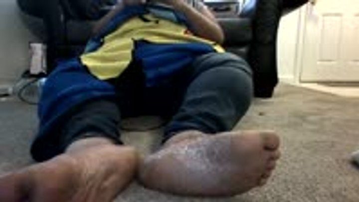 Fatbodyuglyfeet - Candid Cam of dry feet