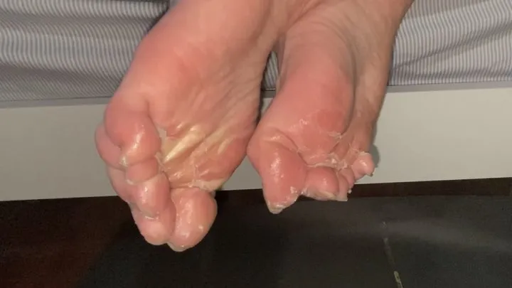 Dpfeet - Bare toes stuck fast with superglue