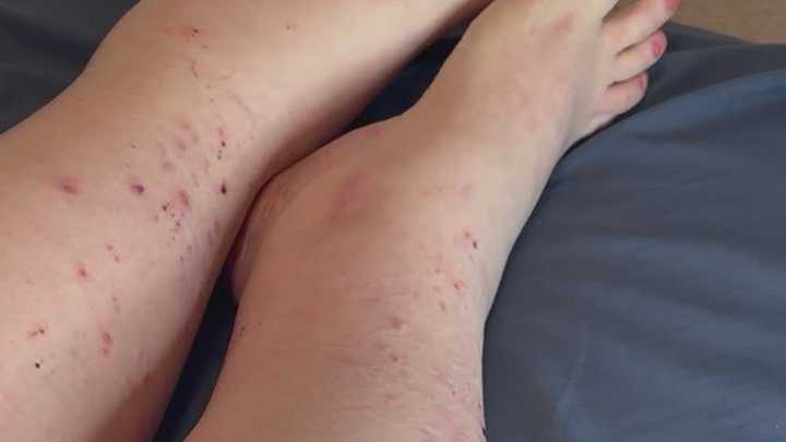 Ssbbw Hexsii - Ssbbw Hexsii slow motion swollen feet