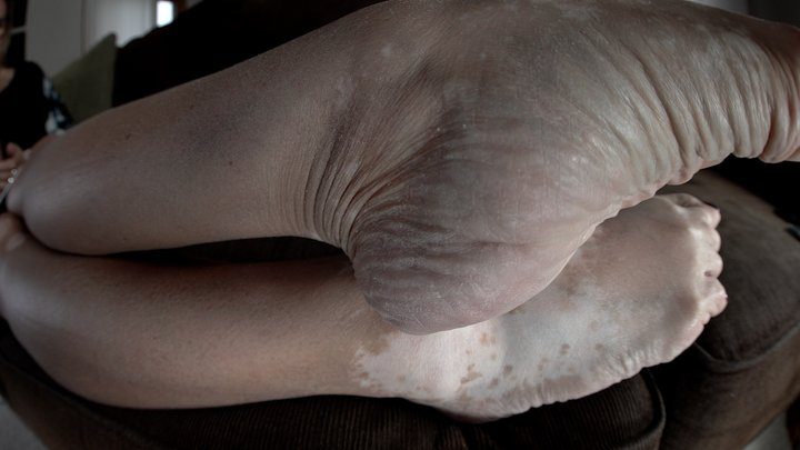 Hfw - Sexy Arches In My Shoes, 1st