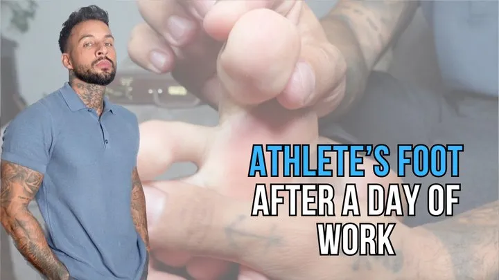 Lalo Cortez - Athlete’s Foot After a Day of Work - Lalo Cortez