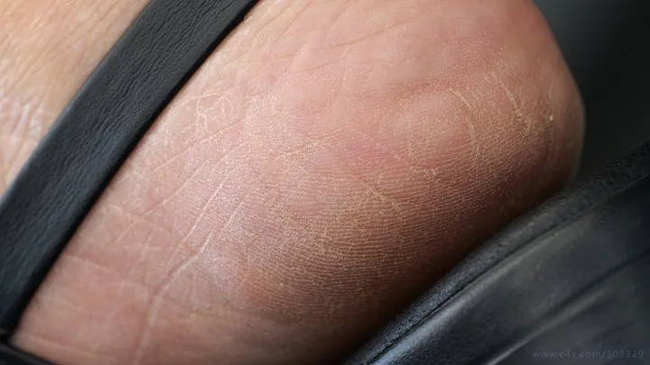 Footworshiplovers - Foot and sandal fetish admiration, feet close-up skin details, heels, arched sole and toes.