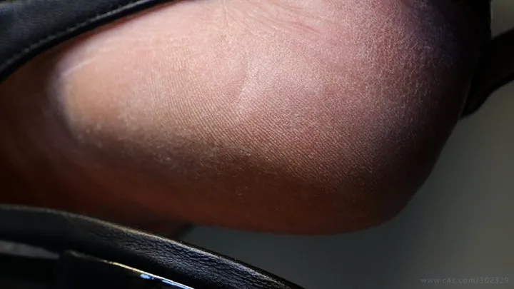Footworshiplovers - Foot fetish admiration, feet heels close-up, flat sandals. Feet skin particular fetish