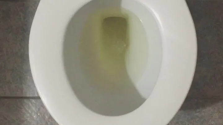 Stage - I PISS GOLD
